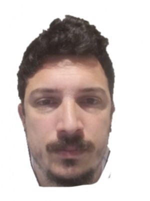 GALANZINI