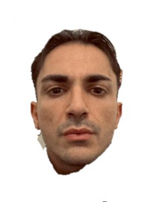 SERVELLO