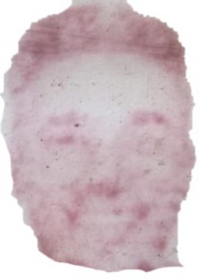 PIU