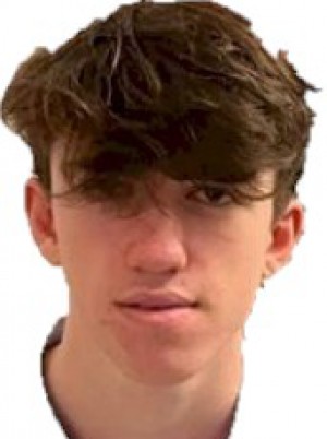ANGIOLANI