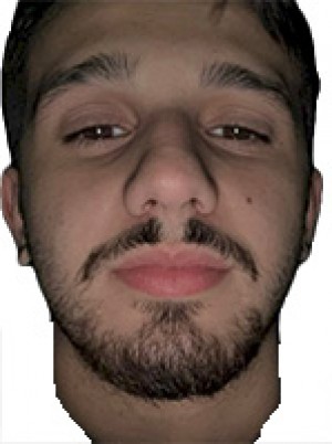 OTTONELLO