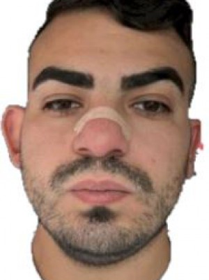 NOCENTINI