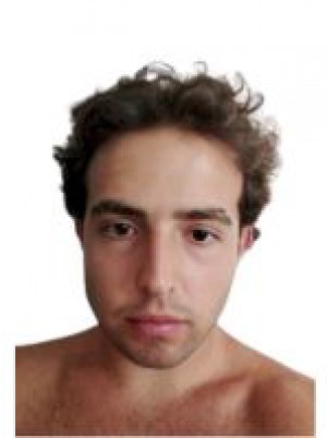 SERPE