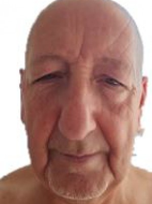 MOLINARO