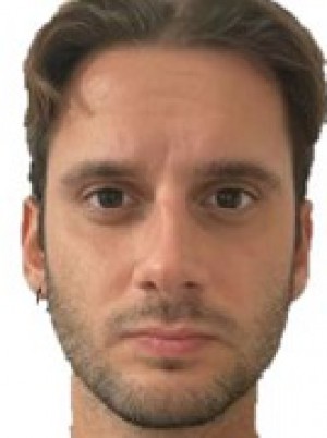 NALBONE