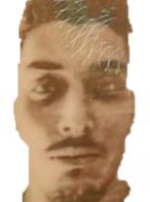 PELLIGRA